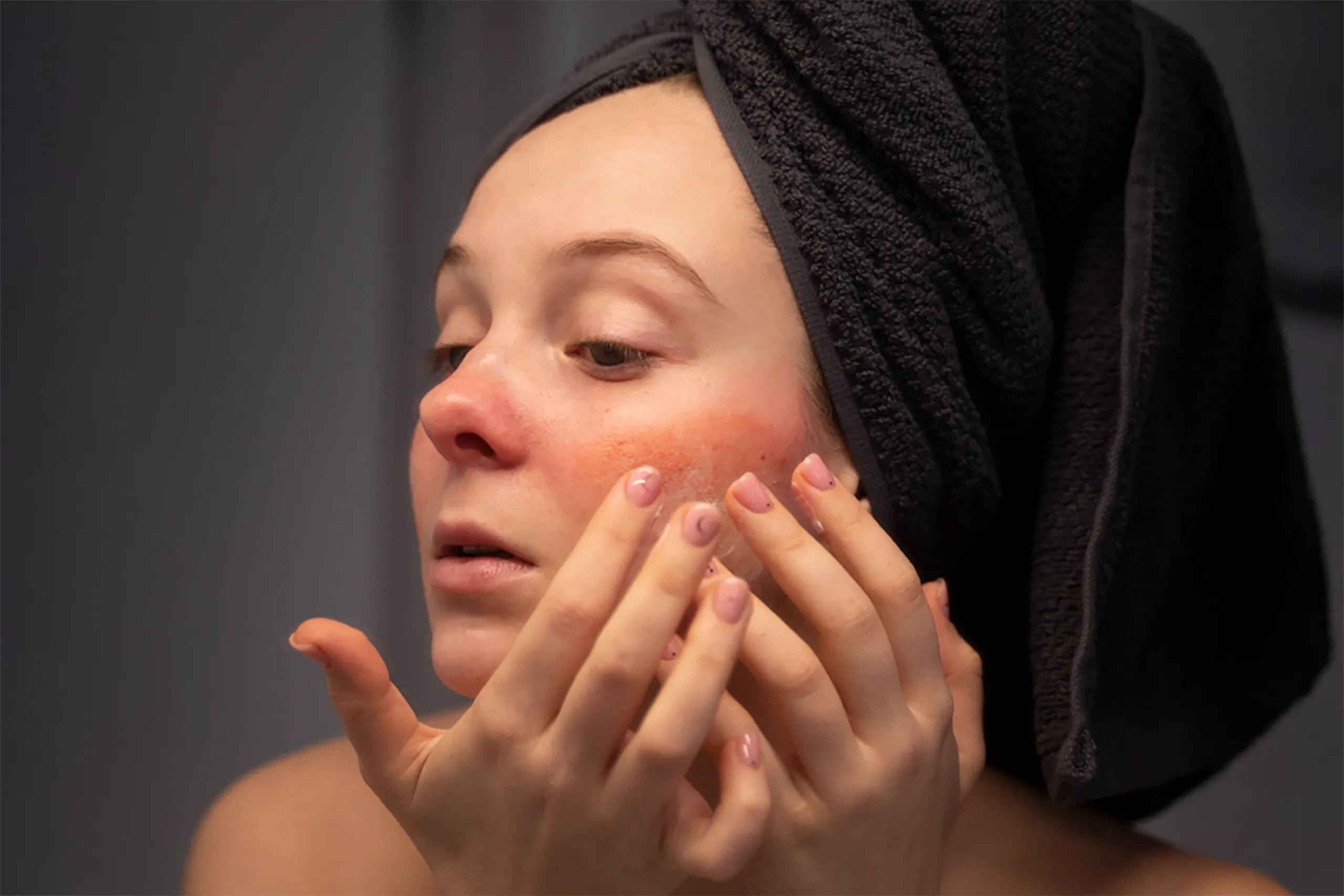 Tackling dry winter skin
